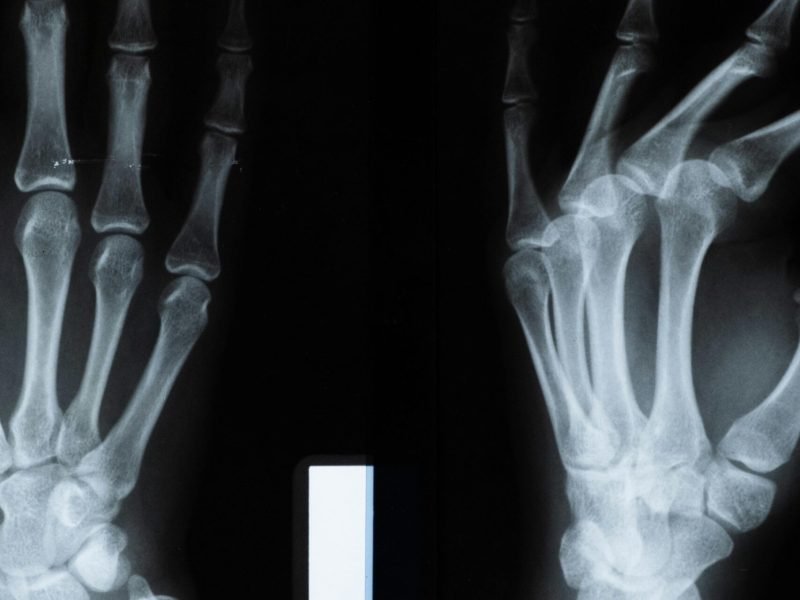 pexels-cottonbro-5723882